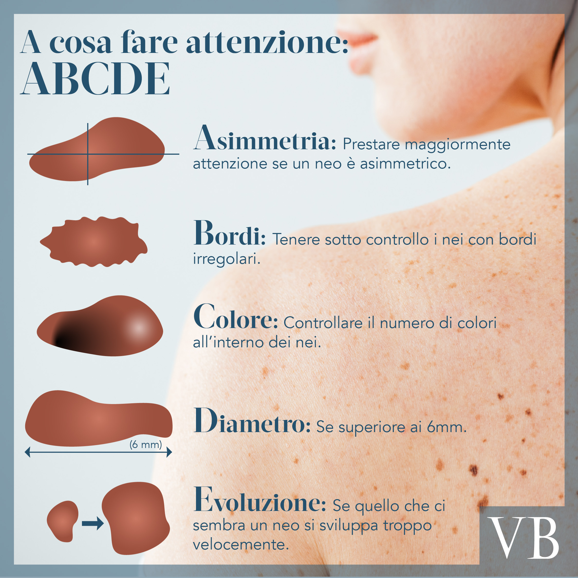 Melanoma3